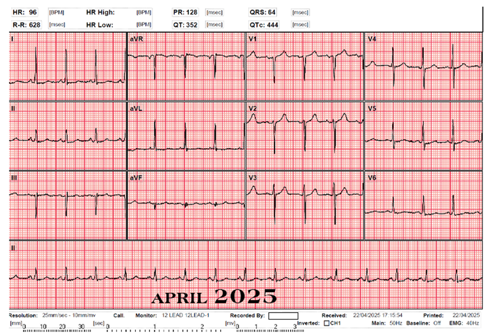 ECG2526_01_01